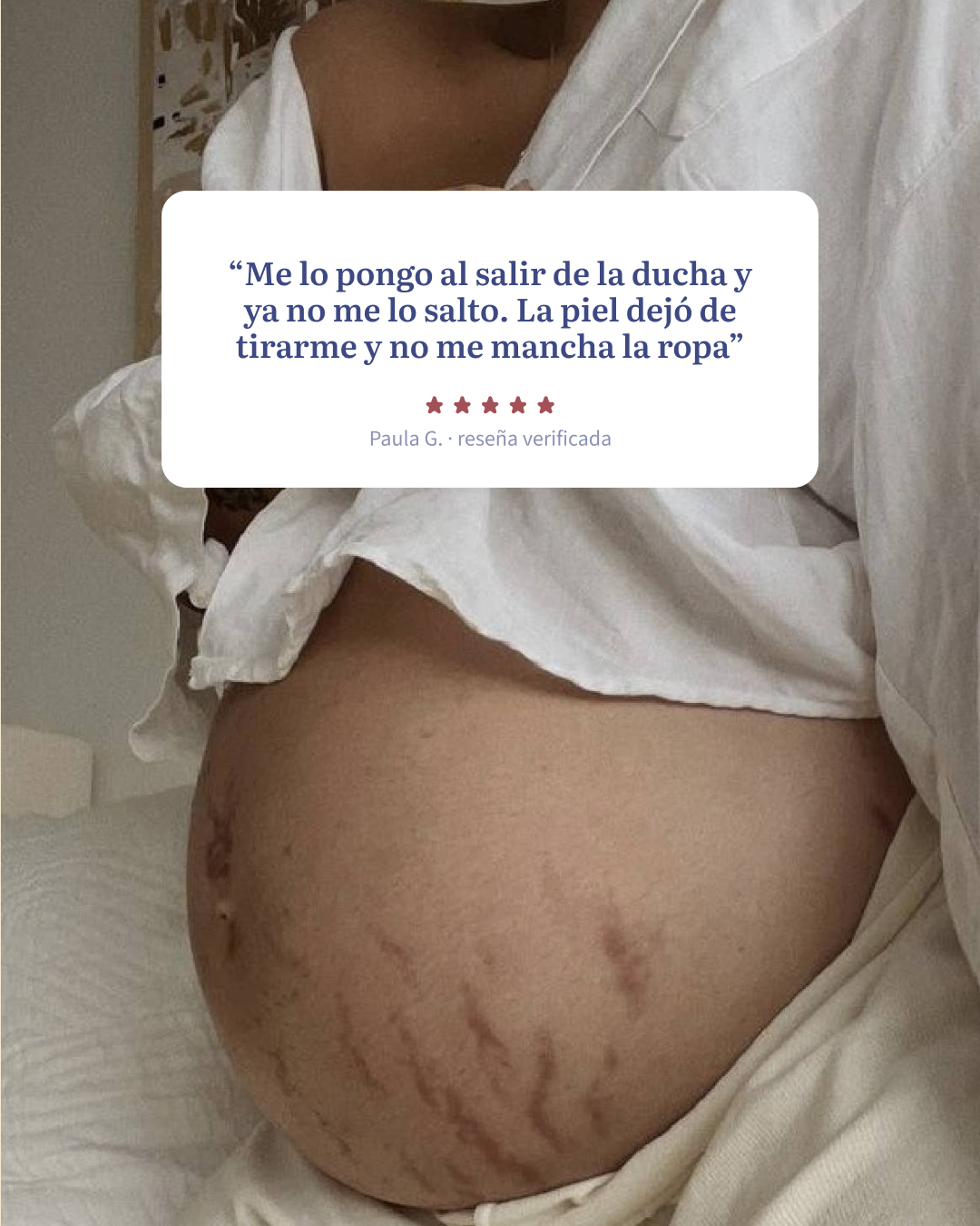 Bálsamo para estrías con Regestril™ · Love Lines de SoKind