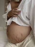 Love Lines balsamo emolliente per le smagliature