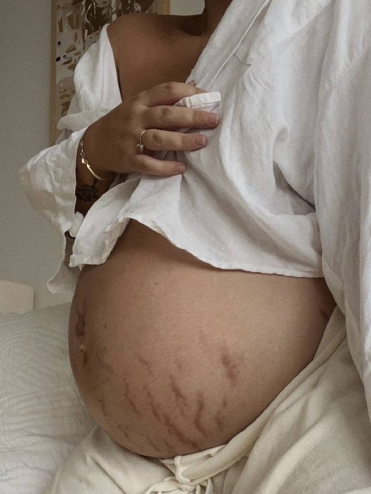 Love Lines balsamo emolliente per le smagliature