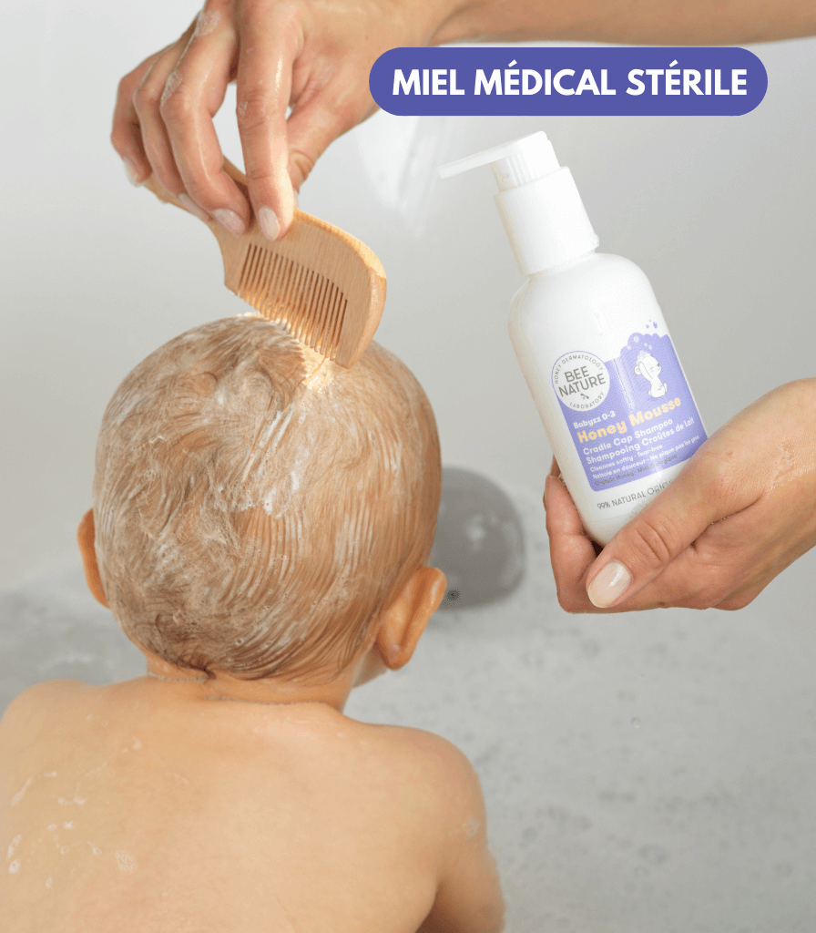 Shampoo trattante per la crosta lattea con schiuma al miele