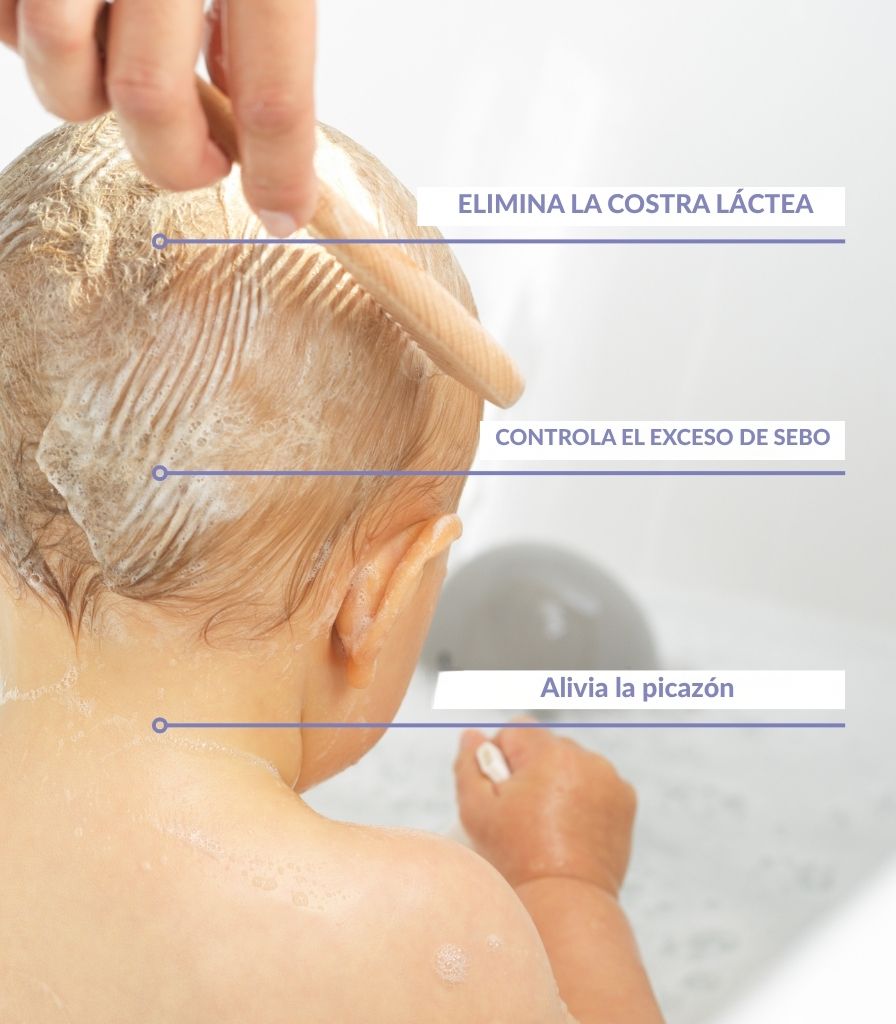 Champô de tratamento para a crosta láctea
